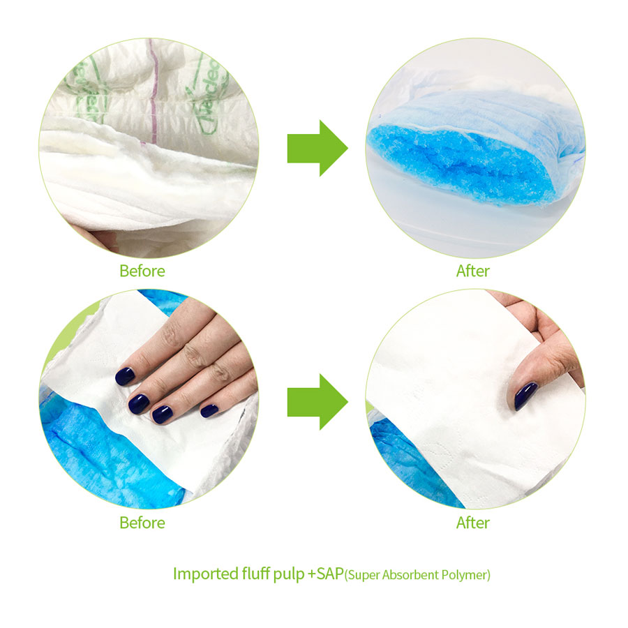 customizableprinting adult diapers 